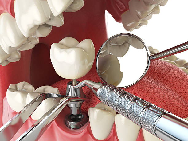 Best Emergency Broken Tooth Repair in Mobile, AL